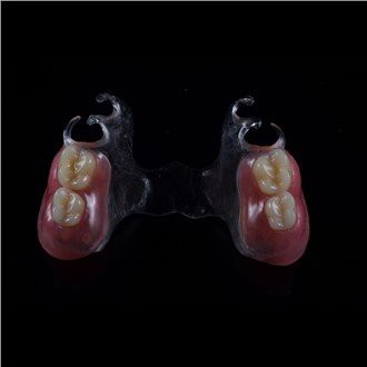 Hàm giả một phần acrylic có thể tháo rời