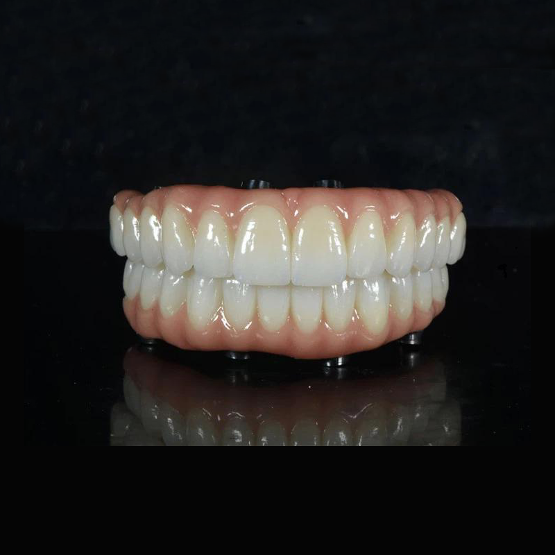 CẦU ALL-ON -X ZIRCONIA