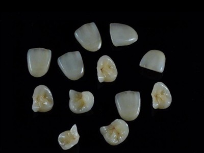 Cách chọn keo nha khoa tốt nhất cho mão răng: Hướng dẫn mới nhất