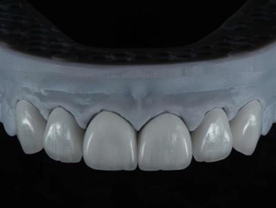 Cách thuê kỹ thuật viên phòng thí nghiệm nha khoa làm việc ở nước ngoài: Hướn...