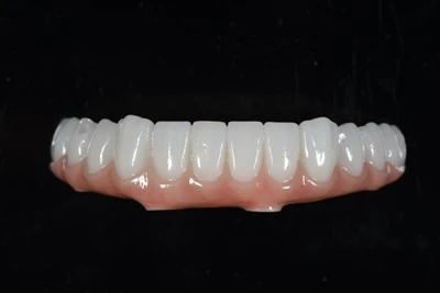 Cầu răng hàm dưới Tất cả-trên-X Zirconia